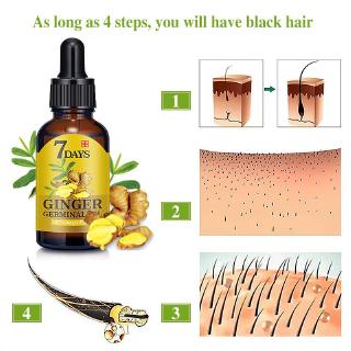 【Spot】1 comprimido de aceite de jengibre de 7 días de edad 30 ml anti-pérdida de cabello suero daño y reparación crecimiento cuidado del cabello esenciaBeauty (8)
