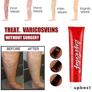 Alivia dolor/reducir el sudor Hidratante Vein/mejora la pierna compleja/crema para adelgazar