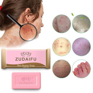 Venta caliente jabón de azufre limpieza de la piel acné seborrea Anti hongos jabón de baño Anti-mite jabón 7g (1)