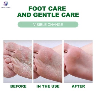 crema de tratamiento de pies exfoliante exfoliante exfoliante crema para el cuidado de los pies (7)