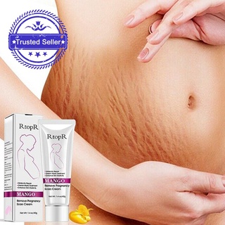mango rtopr embarazo eliminar acné cicatrices crema elástica 40ml q6s1 (1)