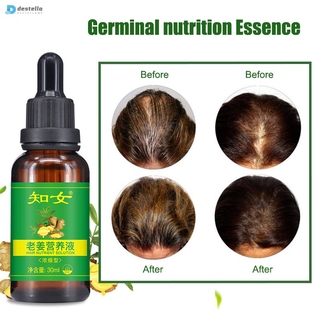 Ginger Germinal Hair Growth Essence Liquid Hairdressing Hair Loss Treatement