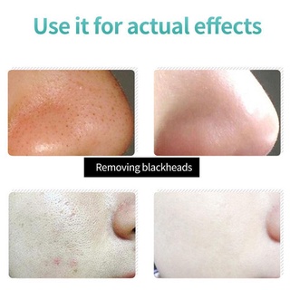 removedor de puntos negros crema mascarilla peeling off tratamiento del acné cuidado de la piel natural c1i3