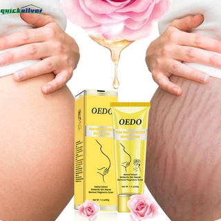 Biu crema Removedora De estómagos antiarrugas Para reparación De maternidad/eliminar cicatrices/Para el embarazo/tratamiento
