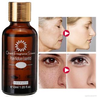 Ultra brillante aceite impecable cuidado de la piel manchas oscuras eliminar Ance blanqueamiento aceite esencial