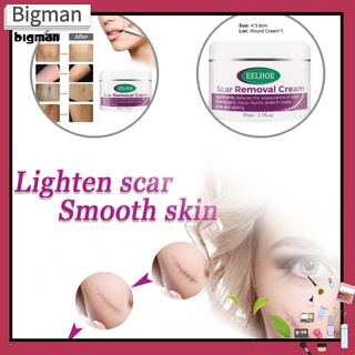 crema de cicatrices de textura ligera grande para eliminar la cicatriz del acné crema de reparación de la piel para prevenir enrojecimiento para estrías gravidarum
