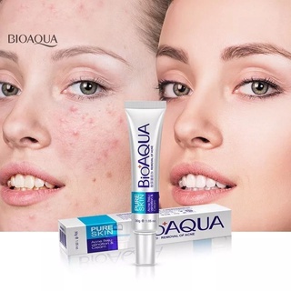 crema pure skin bioaqua remueve acné y ayuda a reducir cicatrices