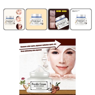 <cod> crema de melanina para el cuidado de la piel/crema de pecas de efecto rápido para eliminar acné para la belleza