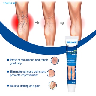 ihufu Portable Leg Swelling Gel Varicose Vein Repair Cream Healthy for Postpartum Obese People