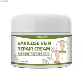Selling Mild Vein Cream Spider Leg Repair Cream Convenient for Postpartum Obese People