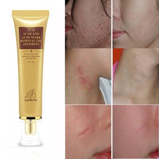 Crema de eliminación de cicatrices de acné estrías acné cicatriz tratamiento del acné cicatriz reparación crema cuidado de la piel 30g