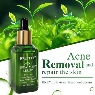 breylee esencia de acné original líquido acné eliminación de acné reparación del acné eliminación de puntos negros f2k3 (2)
