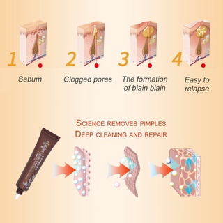 HERBAL ESSENCES limpieza facial suave anti acné refrescante calmante cuidado de la piel esencias herbales (4)