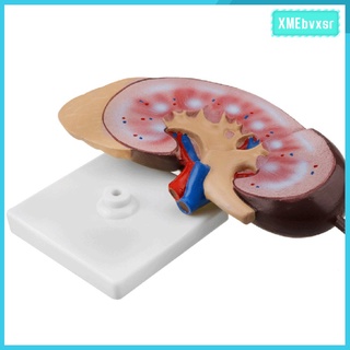 [XMEBVXSR] Enlarged Kidney Anatomical Model Expansion Teaching Aids School Learning Tool Kidney Structure
