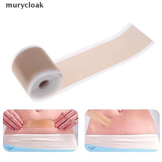 murycloak 4x150cm eficiente cirugía eliminación de cicatrices de silicona gel hoja parche vendaje cinta mx (6)