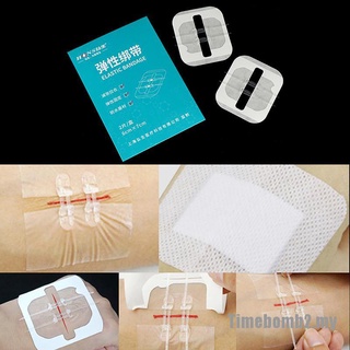 Time2' 1/2pcs cremallera banda ayuda sin dolor cierre de heridas dispositivo sin sutura parche cremallera