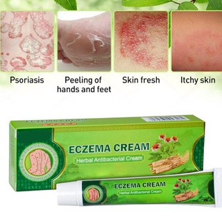 Sumifun Psoriasis Herbal ungüento Dermatitis Eczema tratamiento inhibiendo bacterias eliminar inflamación crema piel antibacteriana 20g