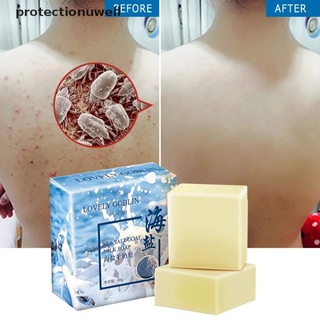 Pwmx Sea Salt Soap Removal Pimple Pore Acne Treatment Goat Milk Soap Glory