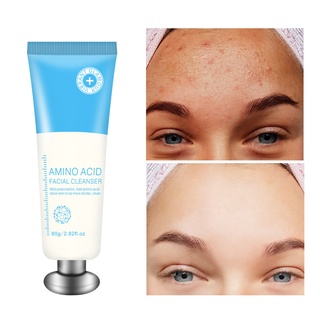 fangbaby aminoácido limpiador facial control de aceite de limpieza profunda eliminar acné hidratante poros retráctiles reafirmante cuidado facial