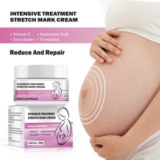 beautyday 100g embarazo cicatriz reparación del acné crema de maternidad reparación Anti-envejecimiento Anti-Winkles reafirmante cremas corporales estrías tratamiento (2)