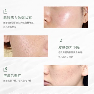 Xue + 2 AOEO Seven Leaf Tree Toner cuidado de la piel Control de aceite Facial viaje humedad profunda (5)