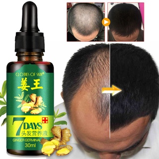 [disponible en inventario] esencia de crecimiento del cabello/ginger 30ml/tratamiento/pérdida de cabello nutritiva nutritiva de raíces capilares/suero de crecimiento del cabello germinal para hombres y mujeres