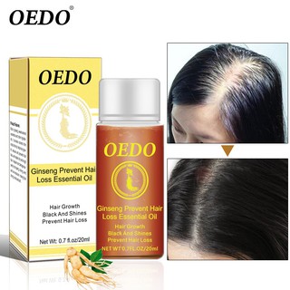 OEDO Ginseng Hair Growth Essential Oil Prevent Hair Loss Nourishing Hair Roots Repair Damaged Hair Hair Care Essence 20ml