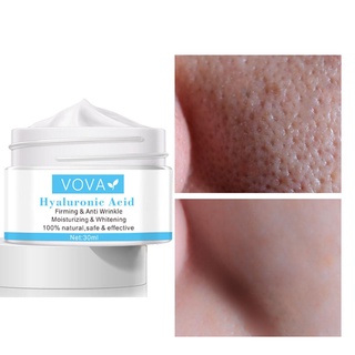 kisshave 30ml crema facial reafirmante piel blanqueamiento facial ácido hialurónico Anti envejecimiento retráctil poros removedor de arrugas crema para mujer (1)