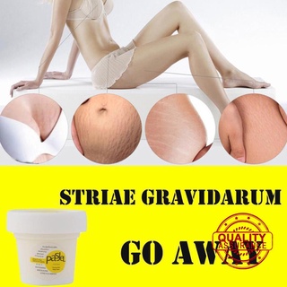Remove Stretch Marks Cream Anti Wrinkle Anti Aging Treatment Pregnancy Skin（50ml） Body S2H6