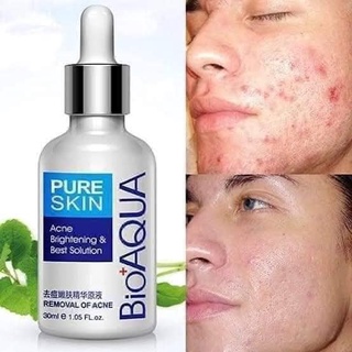 ❄️Serum anti-acne BIOAQUA❄️