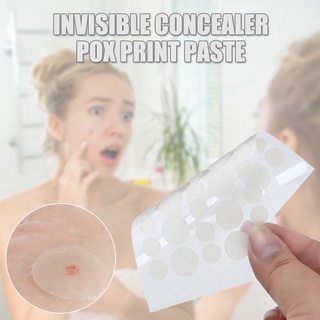 Acne Pimple Patch Invisible Efficient Blemish Protective Cover Zit Stickers for Acne Spot Treatment