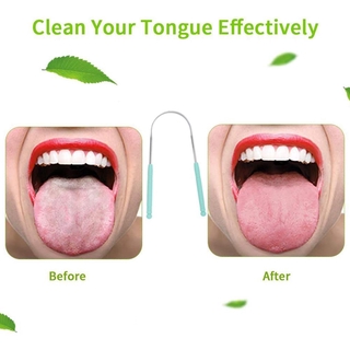 Limpiador de lengua de acero inoxidable/raspador de lengua/herramienta para el cuidado de la cavidad (1)