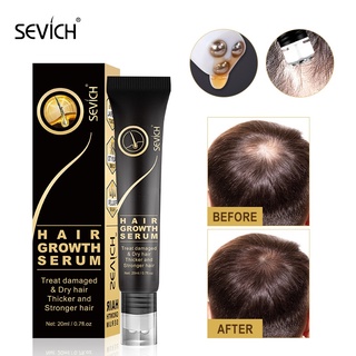 Jengibre esencia nutritiva para el cabello Sevich - Esencia de crecimiento del cabello roll-on Para El Crecimiento Del Cabello