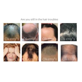 Okeny jengibre crecimiento del cabello esencia Spray 20ml reparación y reparación de aceite de pan esencia hombres y mujeres Anti-pérdida del cabello y prevenir la calvicie (5)