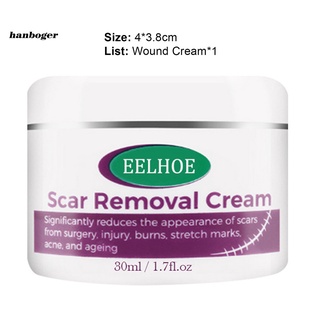 Han_ absorbe rápidamente crema cicatrizante acné crema eliminación de cicatrices prevenir enrojecimiento para estrías Gravidarum (4)