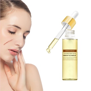 cocodrilo reparación cicatriz eliminar suero tratamiento del acné removedor de estrías anti acné retráctil blanqueamiento de poros aliviar el cuidado sensible (1)