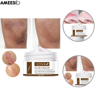 Ameesi Gel reparador Para cicatrices/eliminación De acné/blanqueamiento/Hidratante/crema/blanqueadora/alargamiento Para mujer