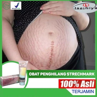 Bpom crema eliminación de celulitis para cicatrices embarazadas Strech marcas antes del éxito (1)