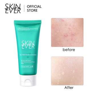Skin EVER limpiador Facial serie limpieza hidratante refrescante blanqueamiento brillante espuma acné limpiador Facial