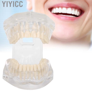 Yiyicc modelo de dientes acrílico transparente simulación Dental para demostración de enseñanza