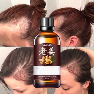 Jengibre rápido crecimiento del cabello suero Anti pérdida reparación tratamiento esencia aceite 30ml litasteful (6)