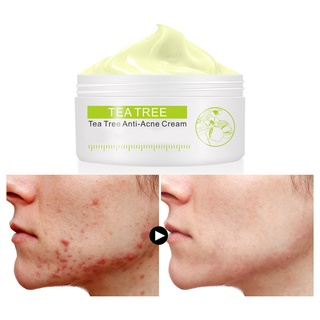fangbaby 30g crema facial de árbol de té anti-acné control de aceite crema para el cuidado de la piel
