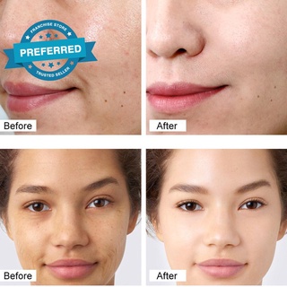 Vibrante GLAMOUR Retinol crema facial Anti-envejecimiento eliminar arrugas piel Lifting blanqueamiento reafirmante K5S3