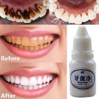 10 ml de agua blanqueadora de dientes/higiene bucal/limpieza de dientes/cuidado de los dientes