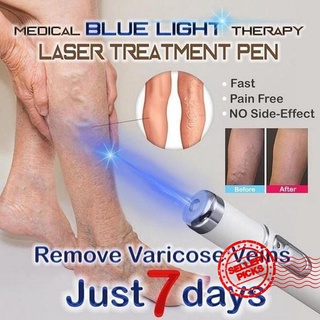 Blue Light Therapy Varicose Vein Pen P0Q0