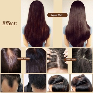 Ginger Fast Hair Growth Serum Anti Loss Repair Treatment Essence Oil 30ml ☆hengmaTimeVip