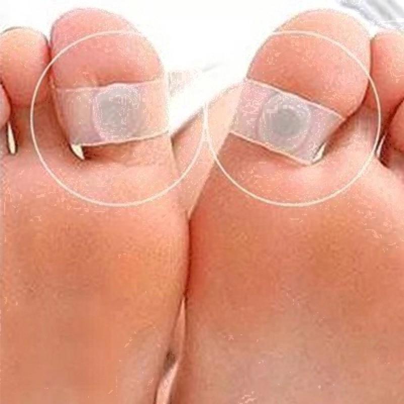 quemador de grasa pérdida de peso anillo de silicona magnético de acupresión anillos de masaje de pies adelgazante eficazmente reducir en el cuerpo (3)