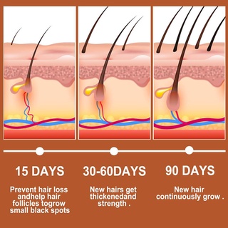 natural planta crecimiento del cabello suero jengibre crecimiento del cabello líquido anti pérdida de cabello suero crecimiento del cabello esencia aceite (7)