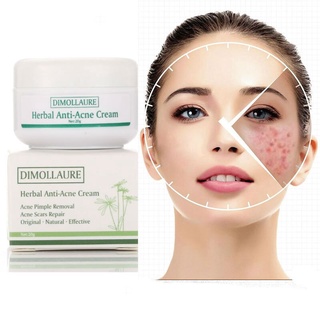majaq dimollaure tratamiento del acné crema de tratamiento de acné remova anti acné crema control de aceite poros retráctiles cicatriz del acné eliminar cuidado de la cara blanqueamiento