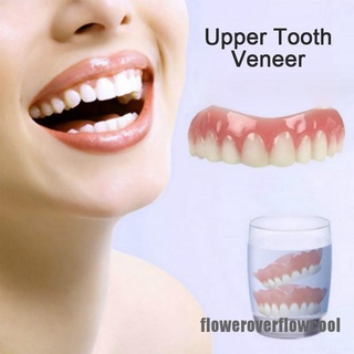 [FCMX] chapa superior de sonrisa perfecta en Stock blanqueamiento dientes dientes postizos dentadura